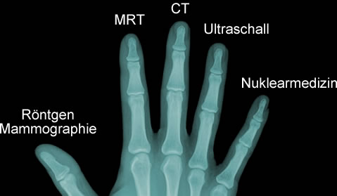 Röntgen, Mammographie, MRT, CT, Ultraschall, Nuklearmedizin